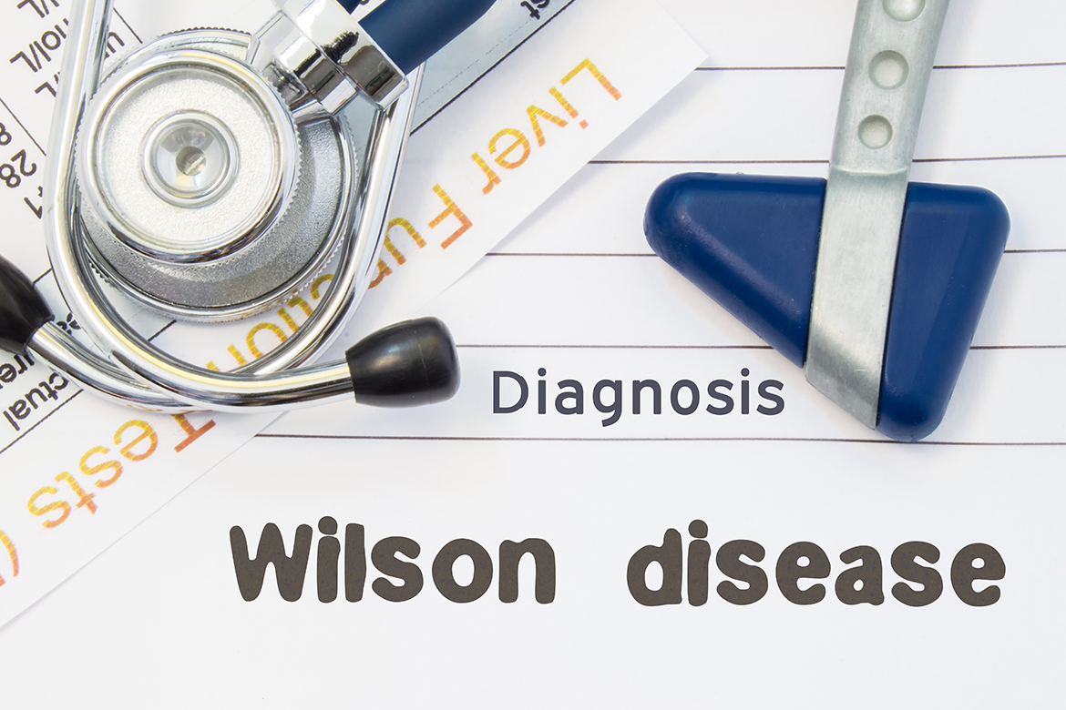 wilson-dises
