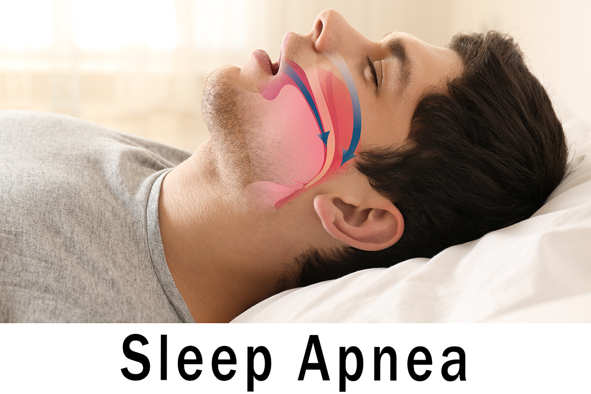 Sleep-Apnoea-Clinic-Getting-A-Snore-Less-Good-Night’s-Sleep-image